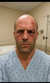 In need of support after injury