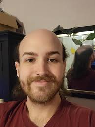 Pourquoi ne puis-je pas le laisser partir quand ça ressemble à ça ? Il faut  franchir le pas : r/bald