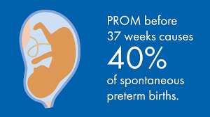 Image result for AmniSure ROM Test