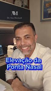 Elevação da ponta nasal., Como eu faço., Neste vídeo explico como realizo o  procedimento para elevar o ângulo nasolabial., Se você possui um nariz com  a ponta "caída", este vídeo pode lhe ajudar., Um ...