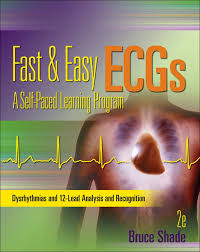 The st segment, t and u waves, and the qt interval a scientific. Buy Fast And Easy Ecgs A Self Paced Learning Program Public Safety Book Online At Low Prices In India Fast And Easy Ecgs A Self Paced Learning Program Public Safety Reviews Ratings