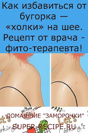 как избавиться от отложения солей на шее в домашних условиях Pin Na Doske Zdorove I Krasota