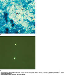 L14.Mycobacteria Species-2023.Ppt