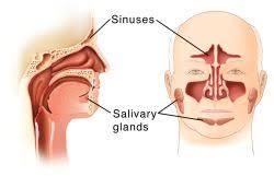 Tumours are groups of abnormal cells that form lumps or growths. Paranasal Sinus Tumors Johns Hopkins Medicine