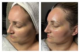 KB E S T H E T I C S 🌿🧖🏻‍♀️🪷💆🏻‍♀️