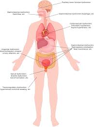 Image result for Autonomic Dysfunction