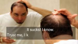 All beta blockers cause hair loss. How To Reverse Hair Loss From Beta Blockers Youtube