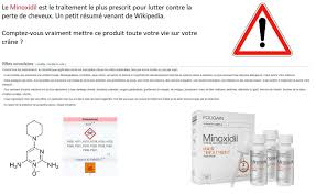 Minoxidil 5 est une solution topique applicable sur la région du cuir chevelu qui souffre d'une perte de cheveux minoxidil 5 est un otc et peut être acheté sans ordonnance. Minoxidil Produit Miracle Ou Arnaque Avis D Ancien Utilisateur