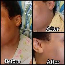 💁Medam & Mesye map invite nou sèvi avèk Bon Savon carotte 🥕 citron 🍋  gingembre avoine 🥙🌽 Prodwi organic Krèm Tumeric 💥 Clay Mask ap retire  mak pitit mak nwa anba bwa