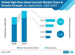 The use of nasal cannula adapted to the infant's nares size to deliver heated and humidified gas at high flow rates has been associated with improvements in washout of nasopharyngeal dead space, lung mucociliary. High Flow Nasal Cannula Market To Grow Exponentially At 11 8 Cagr As Oxygen Therapy Applications Generate Key Opportunities During Covid 19