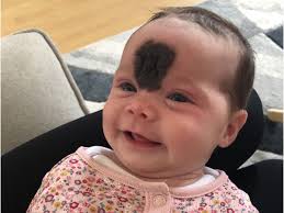 Fundraiser by Celine Casey : Vienna's facial surgical procedures