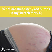 Pin On Pregnancy