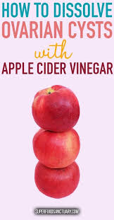 Pin On Ovarian Cysts Remedies