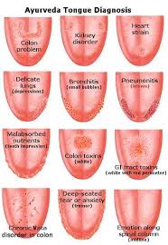 Ayurveda Jihva Parıksa Tongue Diagnosis Ayurveda