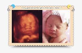 Baby Piper Baby Face 4d Ultrasound Transparent Png 678x453 Free Download On Nicepng The baby boss is back! baby piper baby face 4d ultrasound