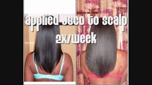 This time we will be using #jamaicanblackcastoroil for 30 days ;once daily and we. Castor Oil Challenge Part 3 Coming Soon Youtube