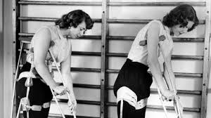 Image result for Polio