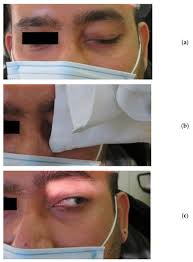 Image result for Ice Pack Test