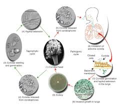However, the symptoms of invasive aspergillosis in the lungs include: Aspergillus Fumigatus Creative Biolabs