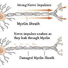 For A Healthy Myelin Sheath You Need Vitamin B12 B12 Deficiency Vitamin B12 Deficiency Low Vitamin B12