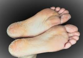 If you think your post has disappeared, see spam or an inappropriate post, please do not hesitate to contact the mods, we're happy to help. Foot Care Tips What Causes Your Feet To Peel Nagy Footcare