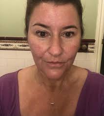 SKIN FIRST Dermal Therapies