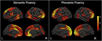 Image result for Verbal Fluency Test