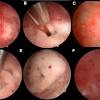 These clinicians form the panel of the adenomyosis awareness network. Https Encrypted Tbn0 Gstatic Com Images Q Tbn And9gcrxof85dvdvumzsr1mt Ddvqalobq 6zz82br507dxc7q0hxda5 Usqp Cau