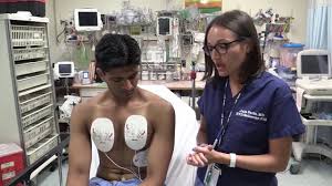 Manual internal defibrillators deliver the shock through paddles placed directly on the heart.1 they are mostly used in the. Proper Defibrillator Pad Placement Dual Sequential Defibrillation Youtube