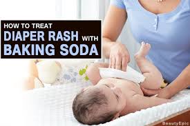 Baking Soda For Diaper Rash How To Treat Them At Home Diaper Rash Baby Remedies Diaper Rash Remedy