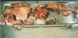 The rig has suffered some serious accidents, most notably an explosive decompression in 1983 that killed. The Remains Of Truls Hellevik After The Byford Dolphin Diving Bell Accident Morbidreality