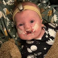 Fundraiser for Steven Strauss by Brian Strauss : Support Baby Henry's  Medical Journey