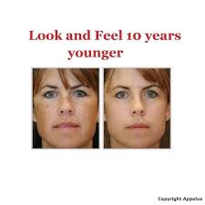 Microdermabrasion Machine