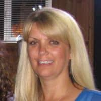 How to Remove Moles, Skin Tags, and Warts With Apple Cider Vinegar