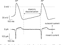Pacemaker (disambiguation) — pacemaker may refer to:in biology and medicine: Figure 1 From Single Cells Isolated From Human Sinoatrial Node Action Potentials And Numerical Reconstruction Of Pacemaker Current Semantic Scholar