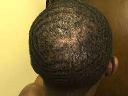 Maybe you would like to learn more about one of these? Need Crown Tips Been Waving For Some Months Now Not Sure If I Ve Really Located My Crown And Isolating The Right Spot And Could Be The Cause Of My Right Side Being Weak