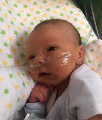 Hi, this is a photo of our little grandson who unfortunately died a week  after this photo. We have no photos of him without tubes or looking  slightly jaundice, please could someone