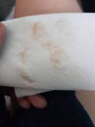Do you experience this type of discharge for more than a week? View Brown Discharge Pictures Of Spotting During Pregnancy Images Wild Country Fine Arts