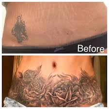 Pictures Of Tattoos To Cover Stretch Marks On Stomach Pin On Tattoos And Scar Cover Up Ink