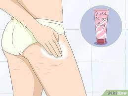 3 Ways To Get Rid Of Stretch Marks At Home Wikihow