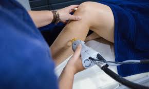 Comparison with other hair removal methods. Laser Hair Reduction Laser Hair Removal Berkhamsted Koha Clinic