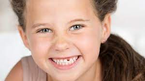 Remportez l'œuvre d'art que vous recherchez. Perte Des Dents De Lait Dr Saumen