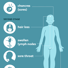 Mar 26, 2019 · syphilis is a sexually transmitted infection (sti) caused by a type of bacteria known as treponema pallidum. Signs Symptoms And Complications Of Syphilis