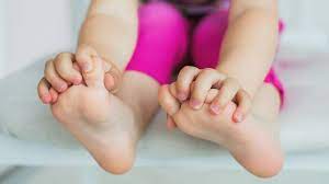 Hand Fuss Mund Krankheit Ansteckung Und Typische Symptome Hallo Eltern