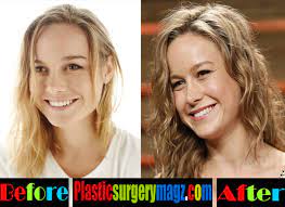 Continue to look youthful thanks to some cosmetic surgery help. Exposed Brie Larson Implants The Life Of Bay 736
