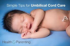 How your baby's umbilical stump heals. Simple Tips For Umbilical Cord Care Philips