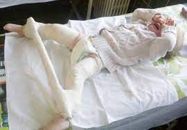 Ecografie transfontanelara, de sold si abdominala pentru bebelusi si copii. Care E Varsta OptimÄ Pentru Ecografia De Sold La Nou NÄscuÅ£i