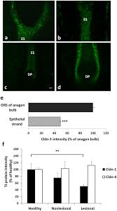 Will i pass a hair follicle. Tight Junction Barriers In Human Hair Follicles Role Of Claudin 1 Scientific Reports