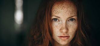 La myélite transverse est un trouble neurologique se manifestant par une inflammation focale aiguë de la moelle épinière. Transverse Myelitis Peter O Donnell Jr Brain Institute Condition Ut Southwestern Medical Center