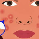 feramat nedir ne ise yarar yan etkileri nelerdir cilt bakimi kapsul recete